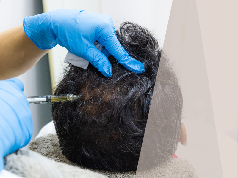 Hair Loss Treatment
